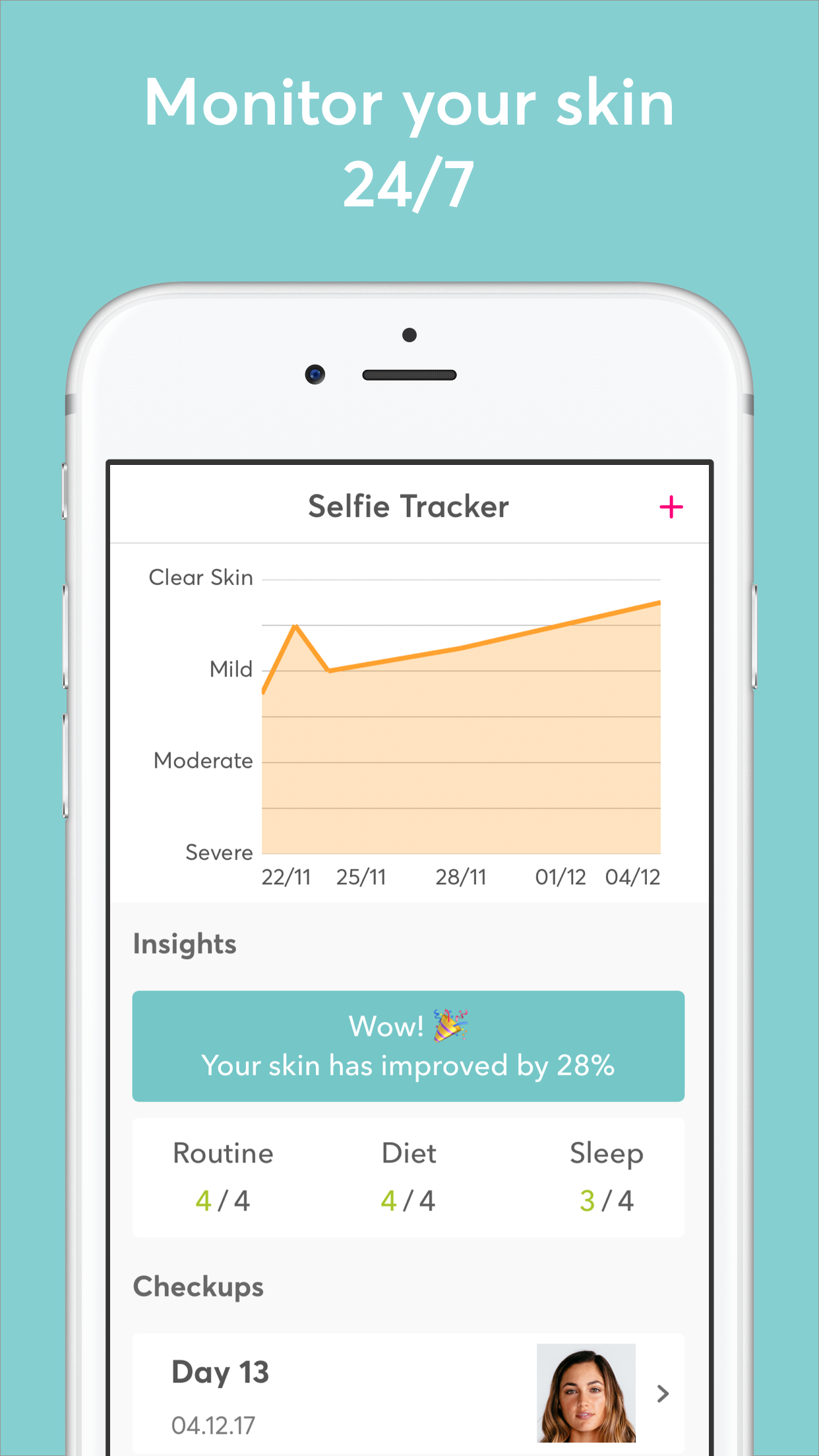 MdAcne app screenshot
